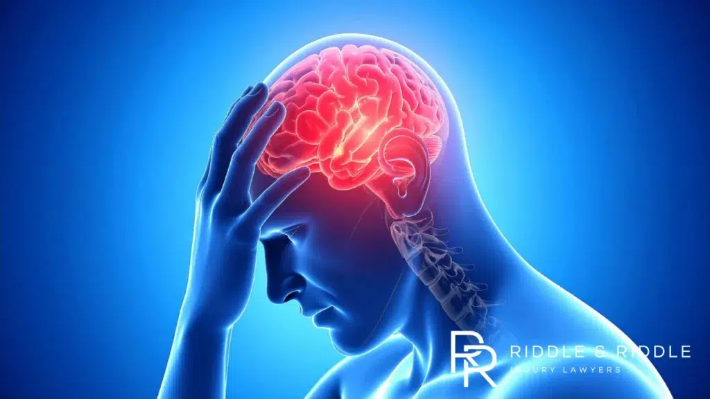 Traumatic Brain Injury Lawyer