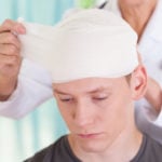 Can I File a Claim for Concussion Injuries from a Car Crash?