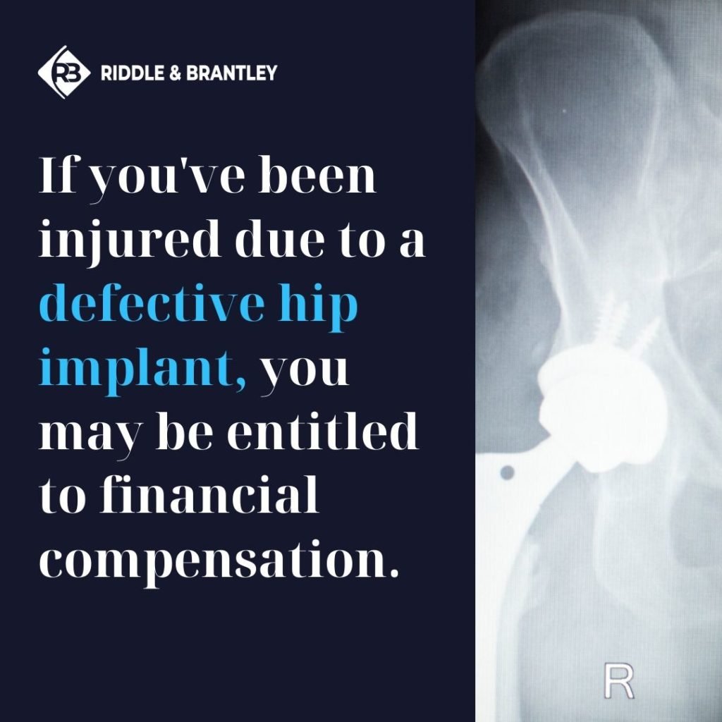 Abogados especializados en implantes de cadera - Riddle &amp; Brantley