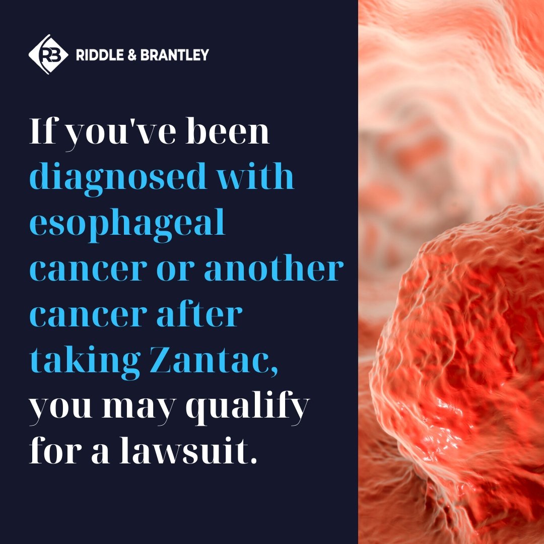 Esophageal Cancer Claim for Zantac - Riddle & Brantley