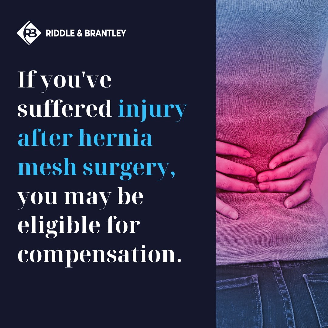 Hernia Mesh Claims for Compensation - Riddle & Brantley