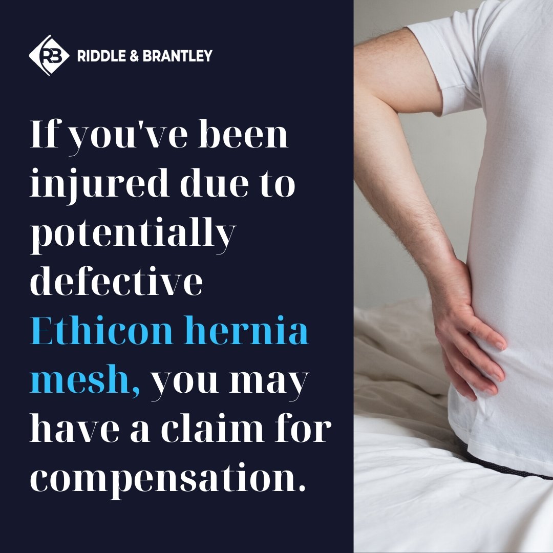 Hernia Mesh Lawsuit Against Ethicon - Riddle & Brantley (1)