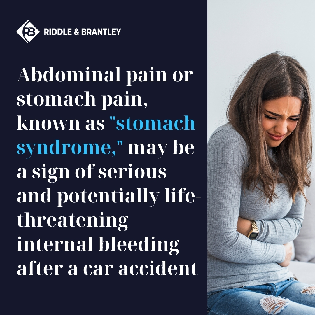 Abdominal pain or stomach pain known as "stomach syndrome," may be a sign of serious and potentially life-threatening internal bleeding after a car accident.