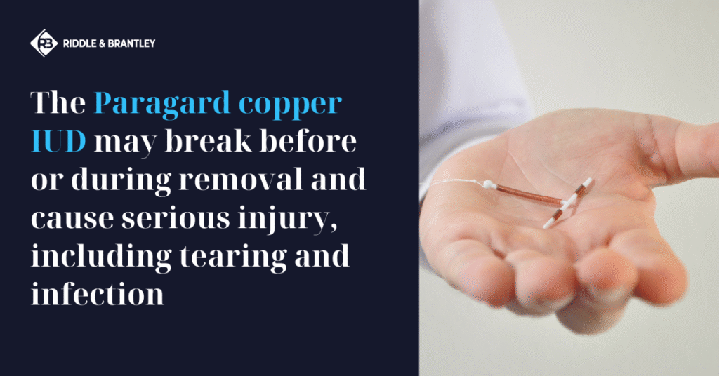 Is the Paragard IUD Safe? Broken Paragard Injuries and Removal