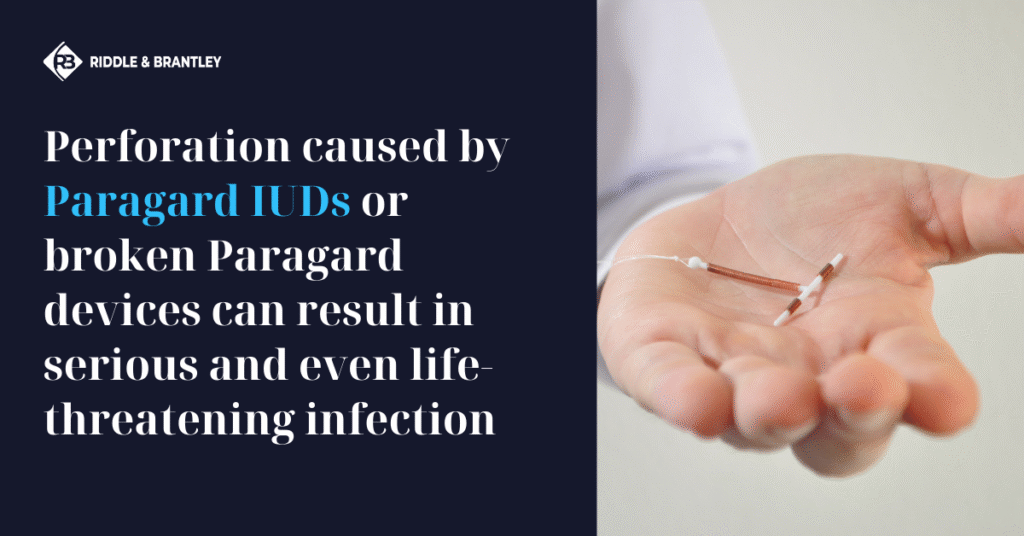 Paragard Infection Do You Have an Injury Claim? Riddle & Brantley