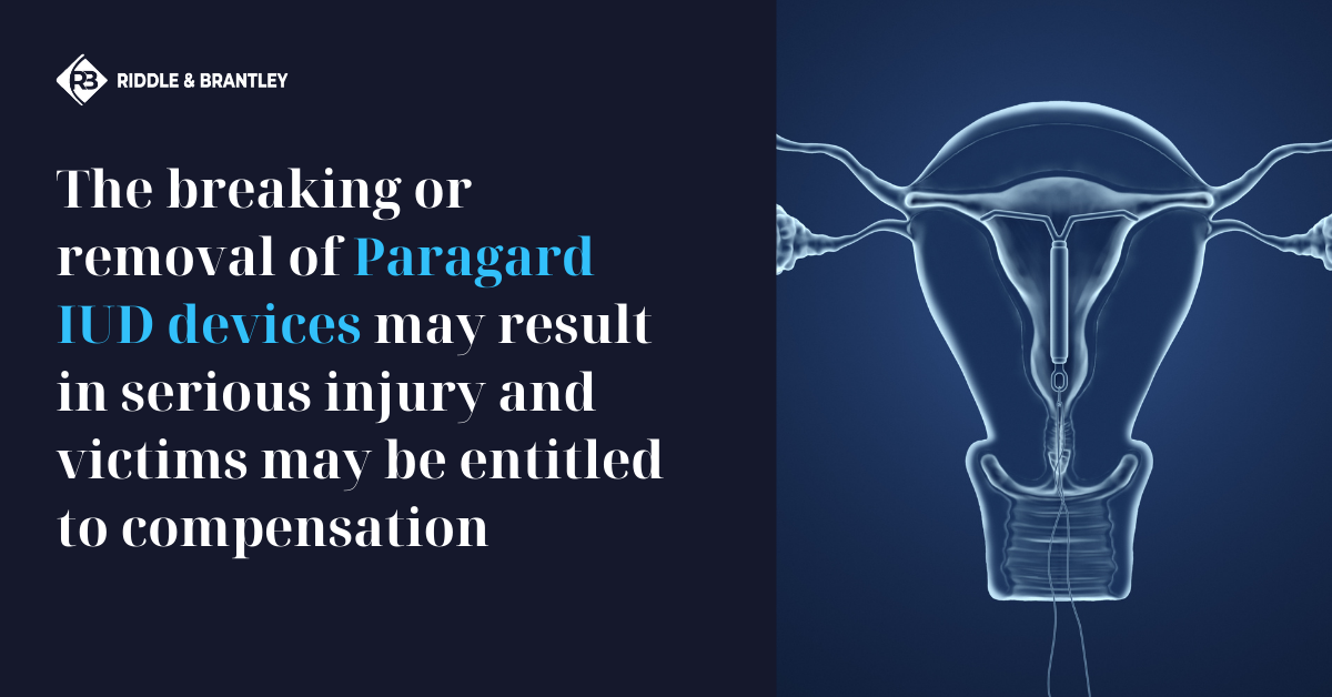 Paragard Removal Injury and Surgery Risk - Riddle & Brantley