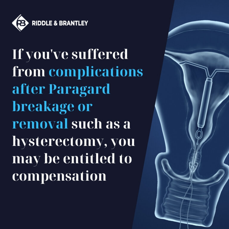"My Paragard IUD Removal Ended in a Hysterectomy. Can I Sue?"