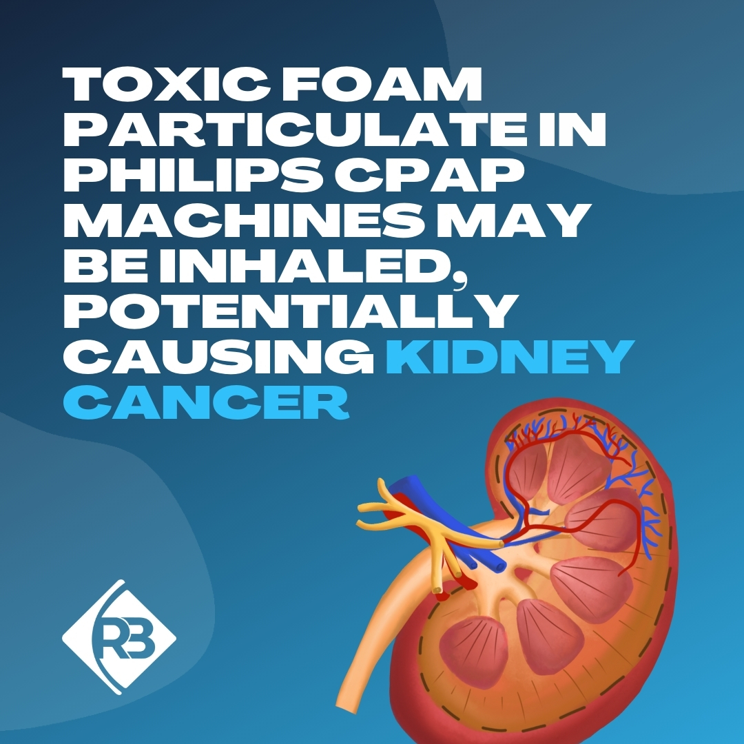 Riesgo de cáncer de riñón en la máquina CPAP Demanda Philips CPAP