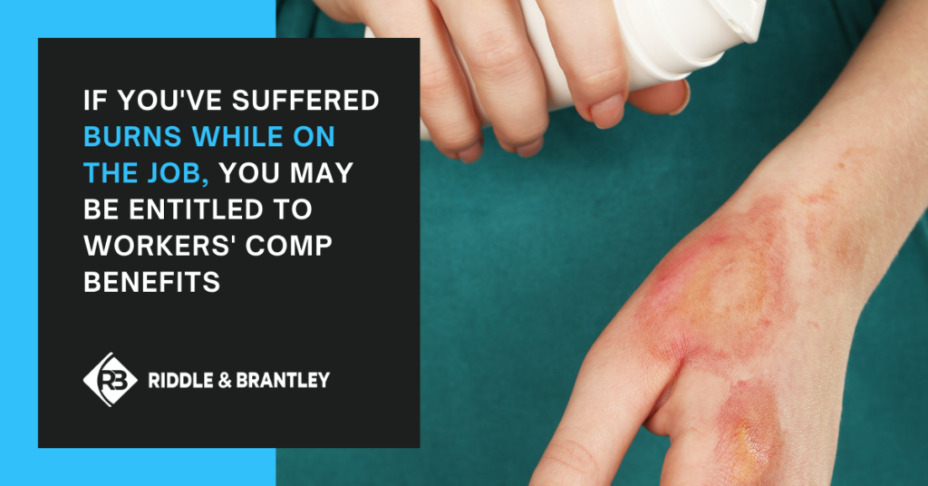 If you've suffered burns while on the job, you may be entitled to Workers Comp benefits - Riddle & Brantley