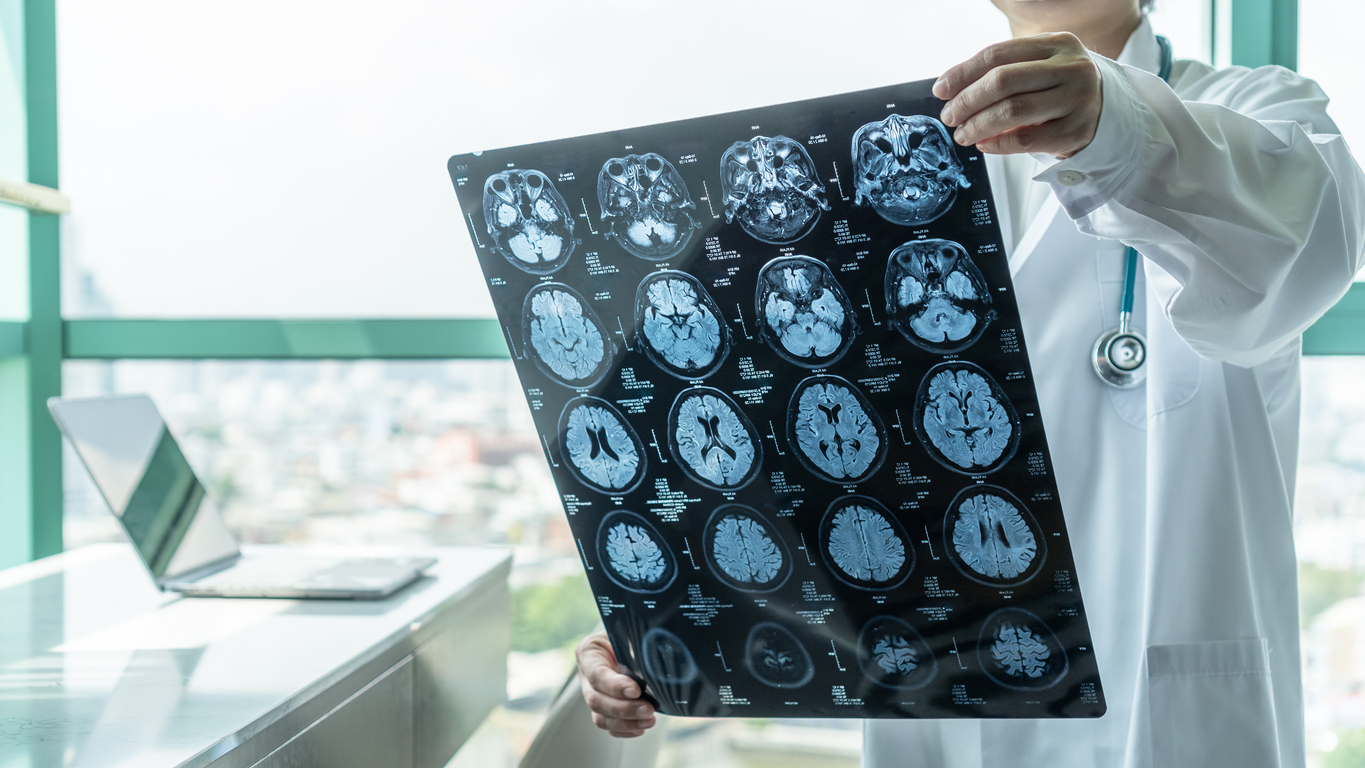 What Are Early Signs and Symptoms of Parkinson's Disease?