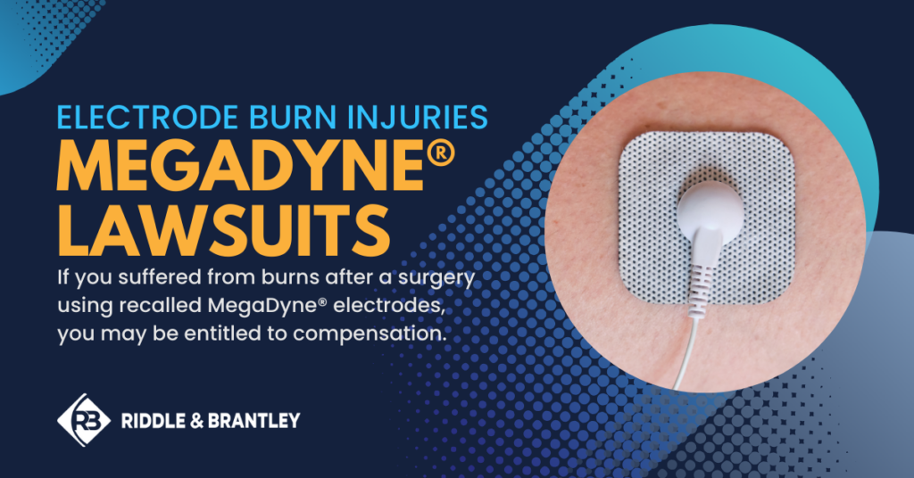 Electrode Burn Injuries - MegaDyne Lawsuits