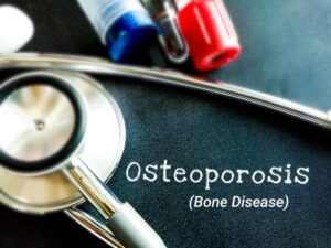 Pérdida de Densidad Ósea