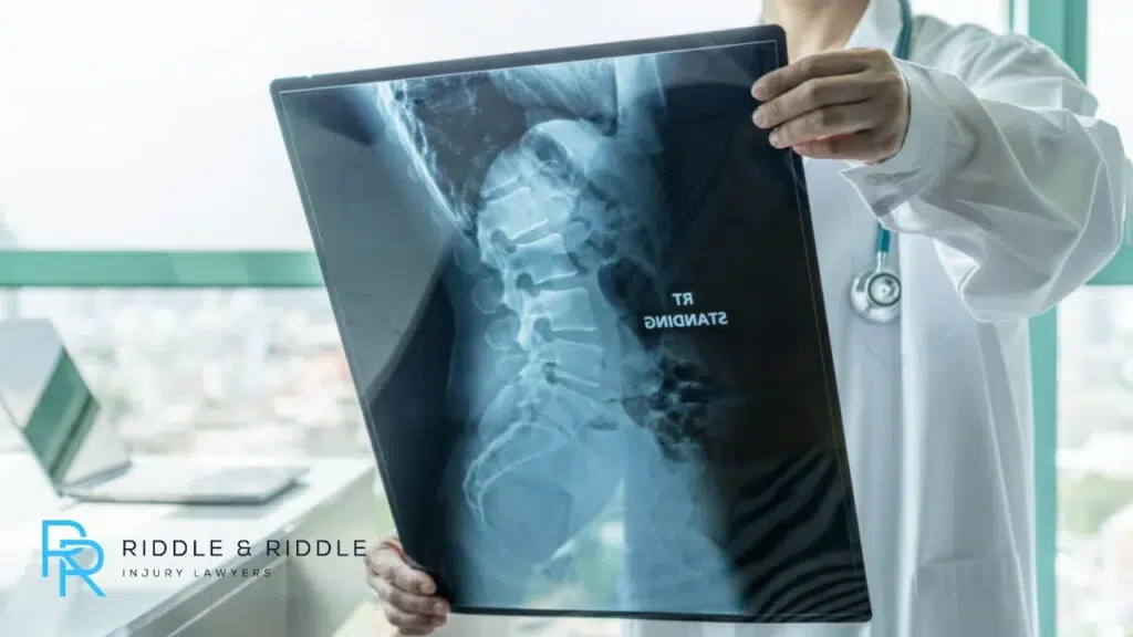 An image of a digital interface displaying a medical radiography X-ray.