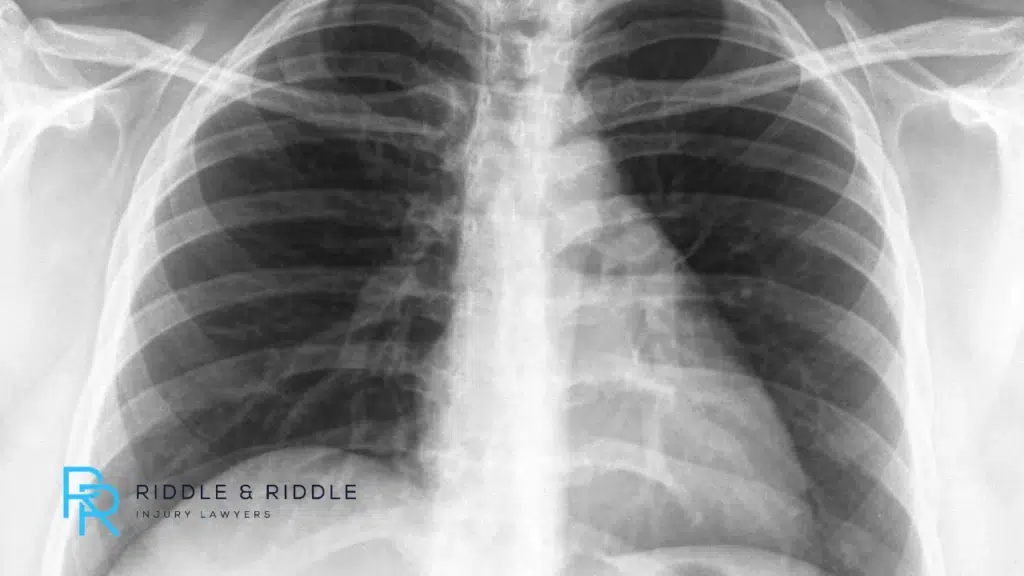 The Digestive System